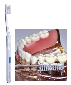 Vitis Implant Angular tandenborstel 1 stuk Dentaid